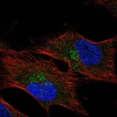 Immunocytochemistry/ Immunofluorescence: HMCN1 Antibody [NBP3-17505]