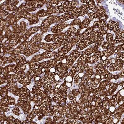 Immunohistochemistry-Paraffin: HMCN1 Antibody [NBP2-30604]