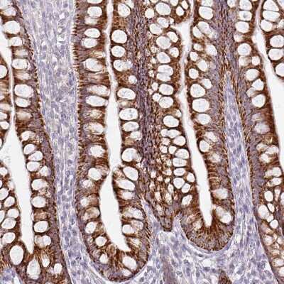 Immunohistochemistry-Paraffin: HMCN1 Antibody [NBP2-30604]