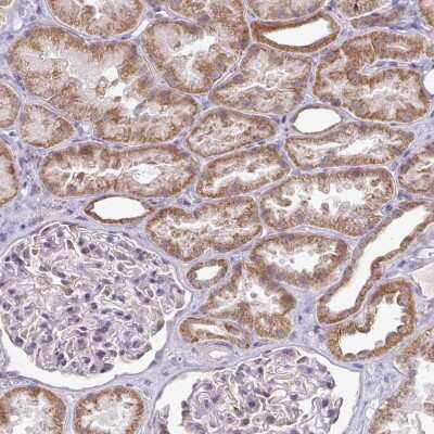 Immunohistochemistry-Paraffin: HMCN1 Antibody [NBP2-30604]