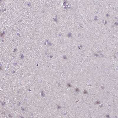 Immunohistochemistry-Paraffin: HMCN1 Antibody [NBP2-30604]