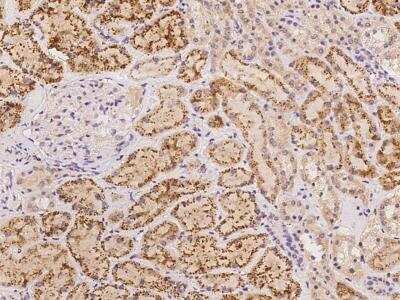 Immunohistochemistry-Paraffin: HMCN1 Antibody [NBP3-06583]