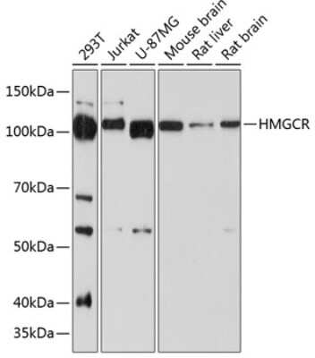 Western Blot: HMG-CoA Reductase/HMGCR Antibody (6Y9L8) [NBP3-15641]