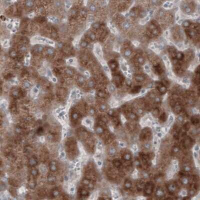 Immunohistochemistry-Paraffin: HMG-CoA Reductase/HMGCR Antibody (CL0259) [NBP2-61616]