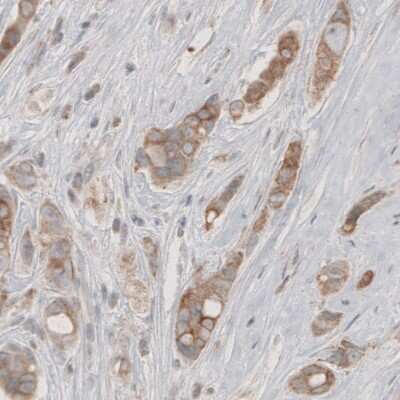 Immunohistochemistry-Paraffin: HMG-CoA Reductase/HMGCR Antibody (CL0259) [NBP2-61616]