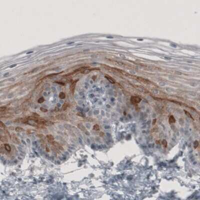 Immunohistochemistry-Paraffin: HMG-CoA Reductase/HMGCR Antibody (CL0259) [NBP2-61616]