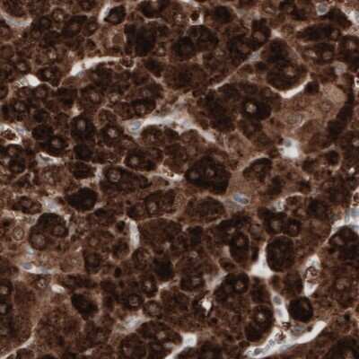 Immunohistochemistry-Paraffin: HMG-CoA Reductase/HMGCR Antibody (CL0259) [NBP2-61616]