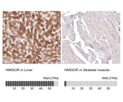 Immunohistochemistry-Paraffin: HMG-CoA Reductase/HMGCR Antibody (CL0260) [NBP2-61617]