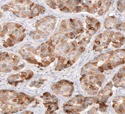 Immunohistochemistry-Paraffin: HMG-CoA Reductase/HMGCR Antibody (CL0260) [NBP2-61617]