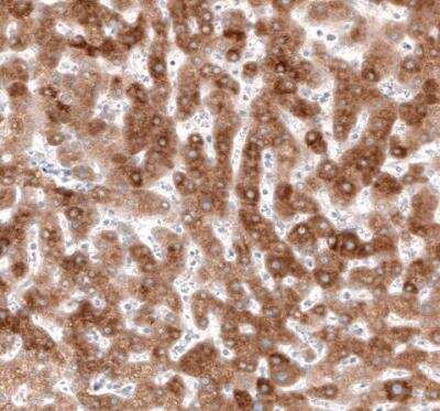 Immunohistochemistry-Paraffin: HMG-CoA Reductase/HMGCR Antibody (CL0260) [NBP2-61617]