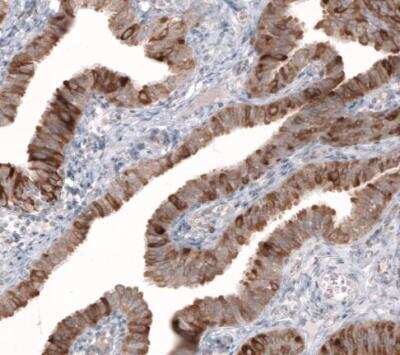 Immunohistochemistry-Paraffin: HMG-CoA Reductase/HMGCR Antibody (CL0260) [NBP2-61617]