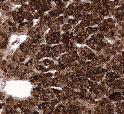 Immunohistochemistry-Paraffin: HMG-CoA Reductase/HMGCR Antibody (CL0260) [NBP2-61617]