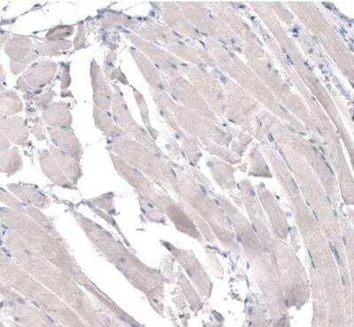 Immunohistochemistry-Paraffin: HMG-CoA Reductase/HMGCR Antibody (CL0260) [NBP2-61617]