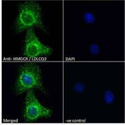 Immunocytochemistry/ Immunofluorescence: HMG-CoA Reductase/HMGCR Antibody [NBP3-05292]