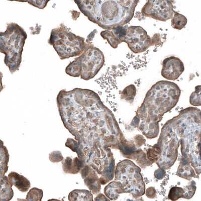 Immunohistochemistry-Paraffin: HMG-CoA Reductase/HMGCR Antibody [NBP1-91996]