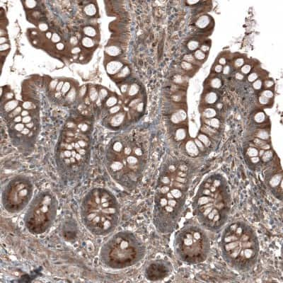 Immunohistochemistry-Paraffin: HMG-CoA Reductase/HMGCR Antibody [NBP1-91996]