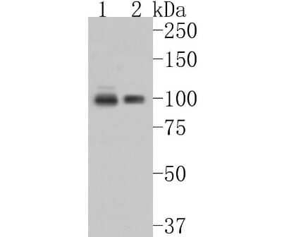 Western Blot: HMG-CoA Reductase/HMGCR Antibody (JF0981) [NBP2-66888]