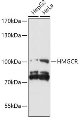 Western Blot: HMG-CoA Reductase/HMGCR AntibodyBSA Free [NBP3-03778]