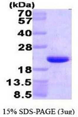 SDS-PAGE: Recombinant Human HMGN1/HMG14 His Protein [NBP1-41146]