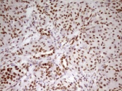 Immunohistochemistry: HMG20A Antibody (OTI2H4) [NBP2-45986]