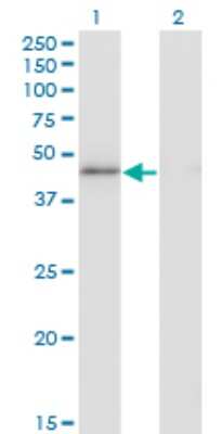 Western Blot: HMG20A Antibody (4D5) [H00010363-M01]