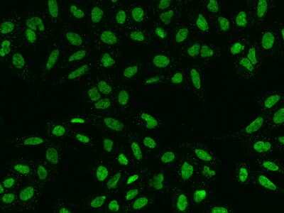 Immunocytochemistry/ Immunofluorescence: HMG20A Antibody [NBP2-97735]