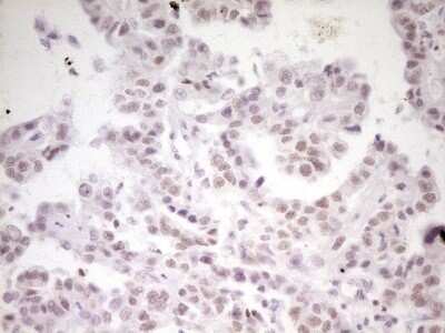 Immunohistochemistry: HMG20A Antibody (OTI2H4) - Azide and BSA Free [NBP2-71596]