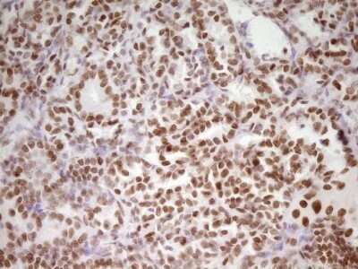 Immunohistochemistry: HMG20A Antibody (OTI2H4) - Azide and BSA Free [NBP2-71596]