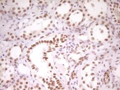 Immunohistochemistry: HMG20A Antibody (OTI2H4) - Azide and BSA Free [NBP2-71596]