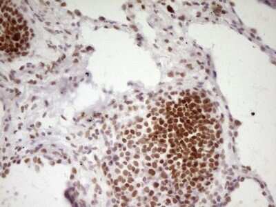 Immunohistochemistry: HMG20A Antibody (OTI2H4) - Azide and BSA Free [NBP2-71596]