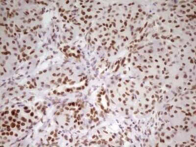 Immunohistochemistry: HMG20A Antibody (OTI2H4) - Azide and BSA Free [NBP2-71596]