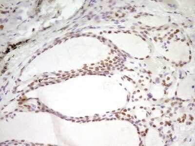Immunohistochemistry: HMG20A Antibody (OTI2H4) - Azide and BSA Free [NBP2-71596]