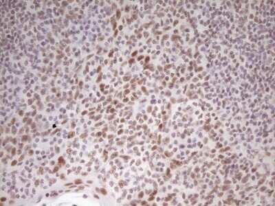 Immunohistochemistry: HMG20A Antibody (OTI2H4) - Azide and BSA Free [NBP2-71596]