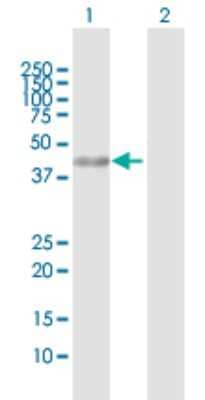 Western Blot: HMG20A Antibody [H00010363-D01P]