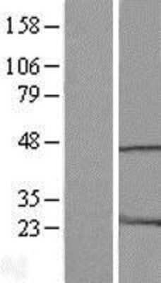 Western Blot: HMG20A Overexpression Lysate [NBL1-11606]