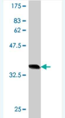 Western Blot: HMG2L1 Antibody (3B4) [H00010042-M01]