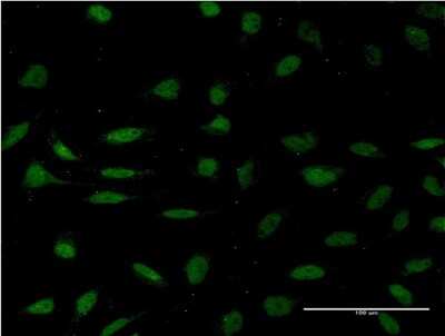 Immunocytochemistry/ Immunofluorescence: HMG2L1 Antibody (3C12) [H00010042-M03]