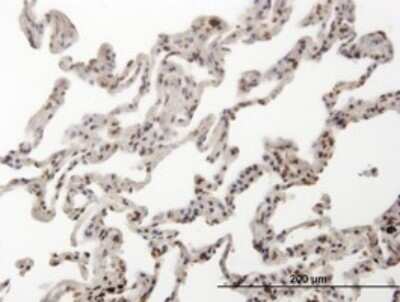 Immunohistochemistry-Paraffin: HMG2L1 Antibody (3C12) [H00010042-M03]