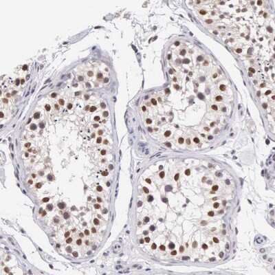 Immunohistochemistry-Paraffin: HMG2L1 Antibody [NBP1-91995]