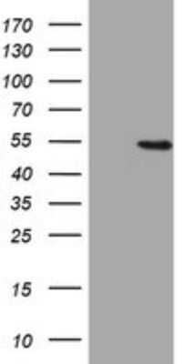 Western Blot: HMG2L1 Antibody (OTI1H10)Azide and BSA Free [NBP2-71538]