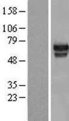 Western Blot: HMG2L1 Overexpression Lysate [NBP2-11296]