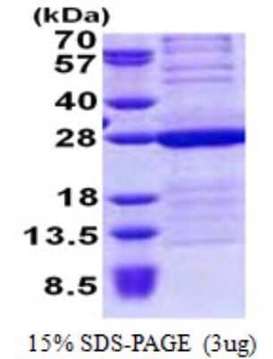 SDS-PAGE: Recombinant Human HMGB3/HMG4 His Protein [NBP2-23123]