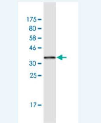 Western Blot: HMGA1 Antibody (2A1) [H00003159-M03]