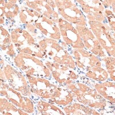 Immunohistochemistry-Paraffin: HMGA1 Antibody - Azide and BSA Free [NBP3-03908]