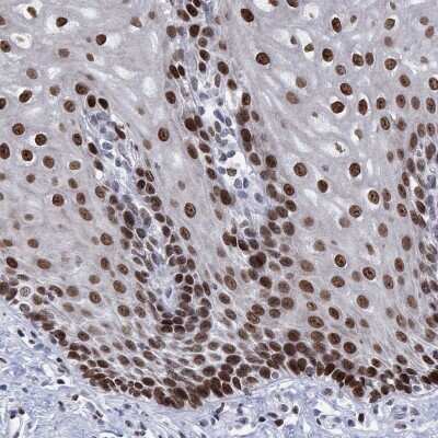 Immunohistochemistry-Paraffin: HMGA1 Antibody [NBP3-17055]