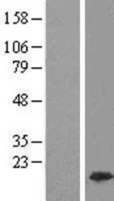 Western Blot: HMGA1 Overexpression Lysate [NBL1-11612]