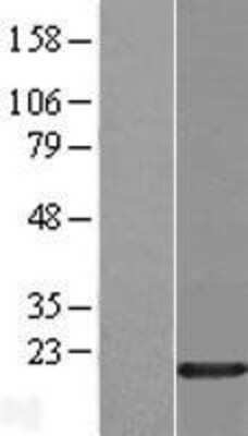 Western Blot: HMGA1 Overexpression Lysate [NBP2-05453]