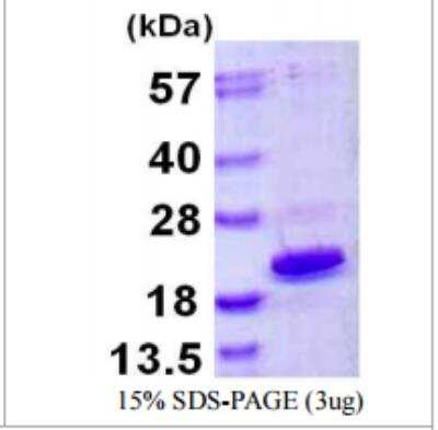 SDS-PAGE: Recombinant Human HMGA1 His Protein [NBP1-72385]