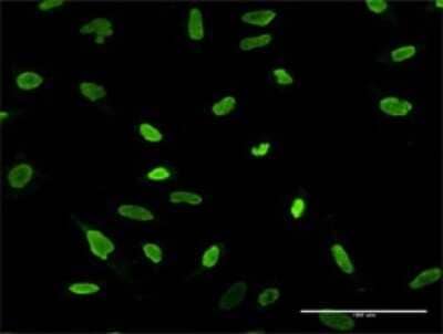 Immunocytochemistry/ Immunofluorescence: HMGA2 Antibody (1D8) [H00008091-M02]