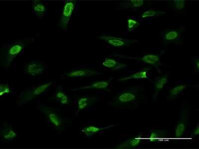 Immunocytochemistry/ Immunofluorescence: HMGA2 Antibody (2D3) [H00008091-M04]